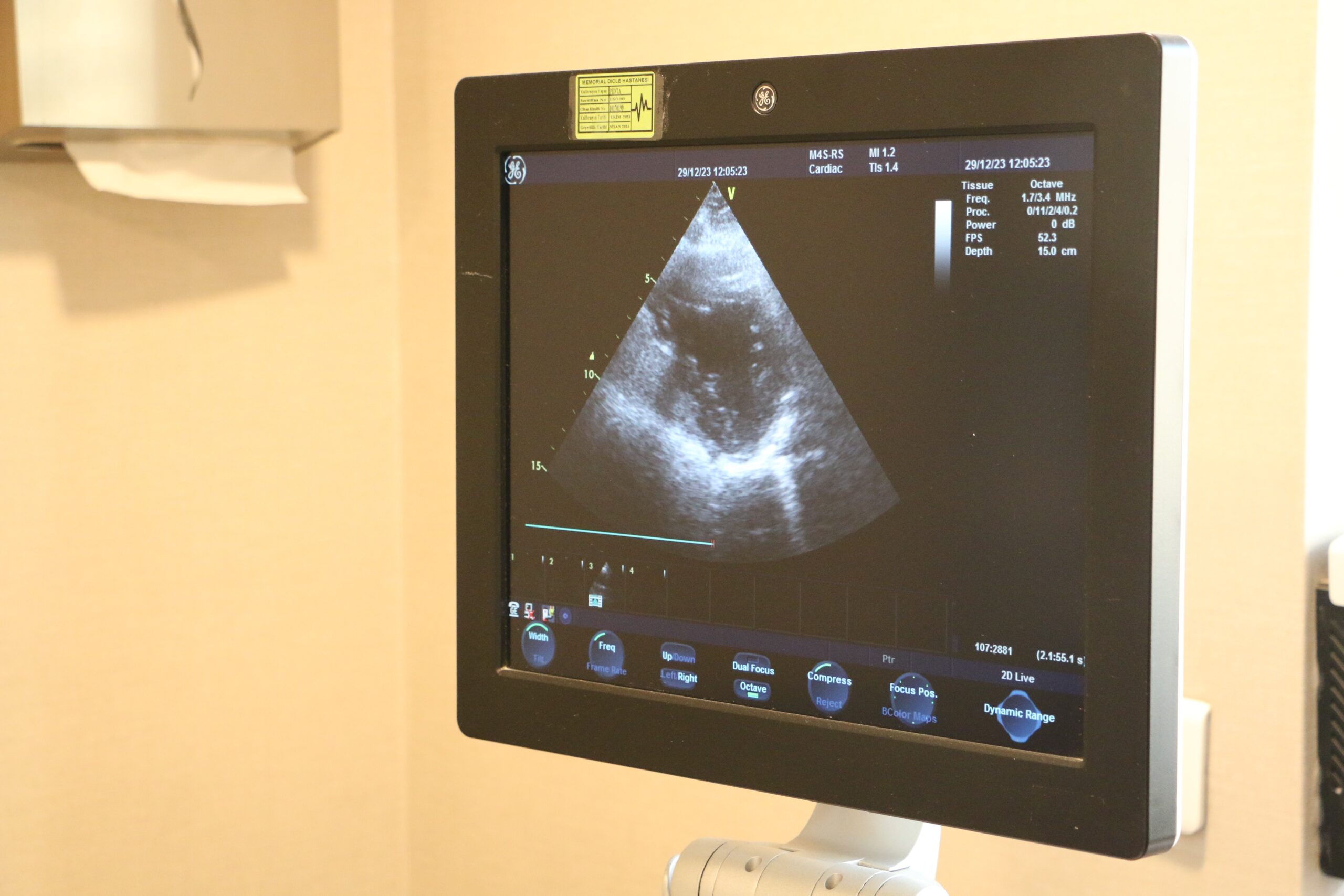 Ayaktaki şişkinlik kalp kapak hastalığının belirtileri olabilir