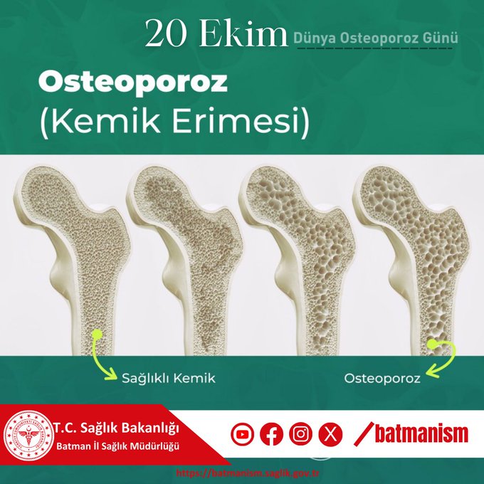 İl Sağlık Müdürlüğü’nden Osteoporoz Uyarısı!
