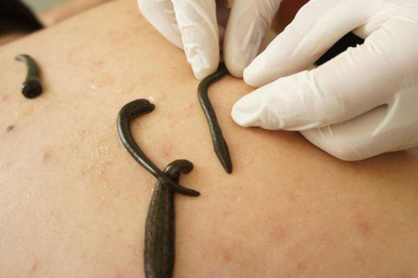 Doktor Ayral: Modern ve Geleneksel Tıp Entegre Edilmeli