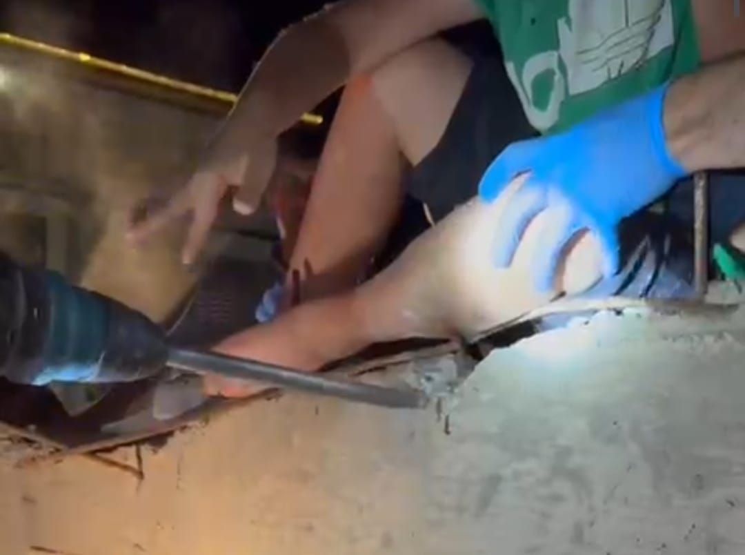 Oyun Kazaya Dönüştü: Bacağına Demir Saplandı