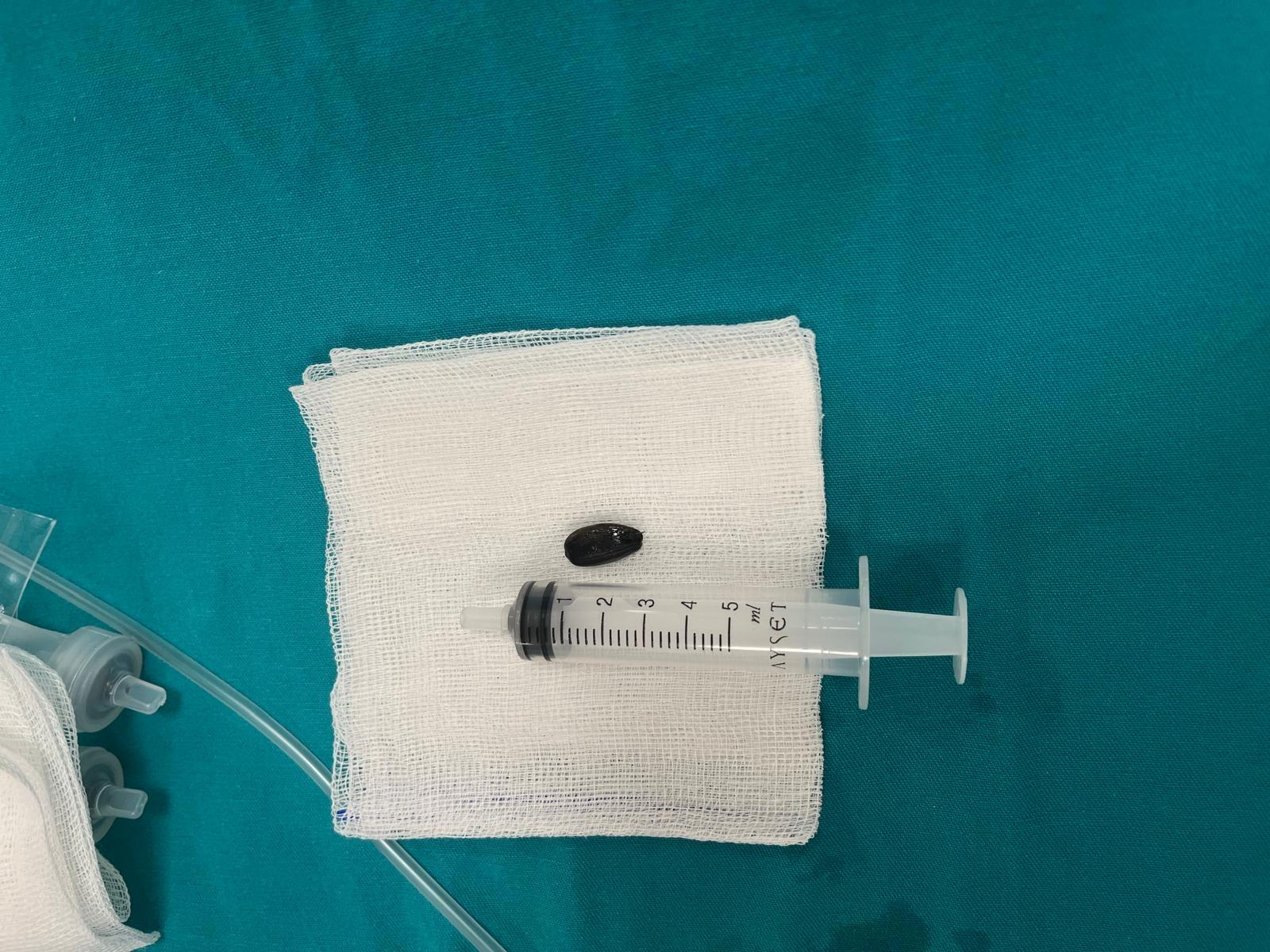 15 Aylık Bebek Çekirdek Kabuklarıyla Nefessiz Kaldı