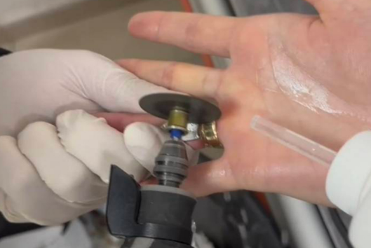 Parmağındaki Yüzük İtfaiye ile Çıkarıldı